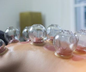 Traditional Chinese Medicine Treatment - Acupuncture