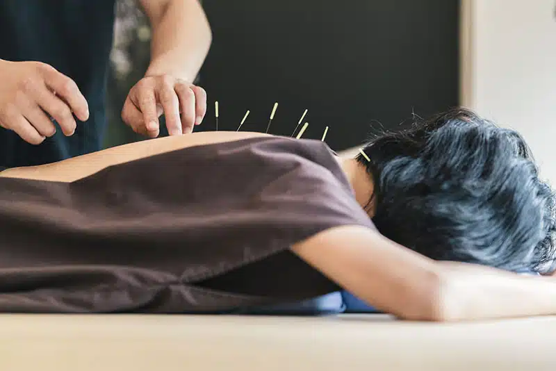 Acupuncture_Banner.jpg (1)